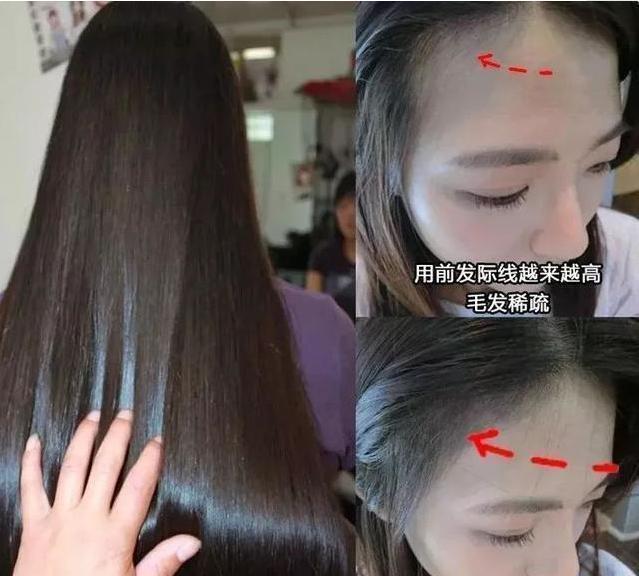 美容 刚打湿头发就涂洗发水,难怪脱发还油得快,告诉你正确洗发方法
