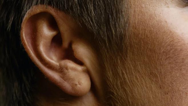 男子坐飞机后听力下降！5年后医生在其耳道发现“这个东西”
