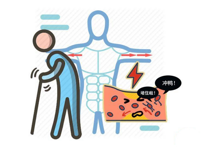 睡眠|睡觉睡出来的怪异,可得多个心眼,有可能是心血管暗示你