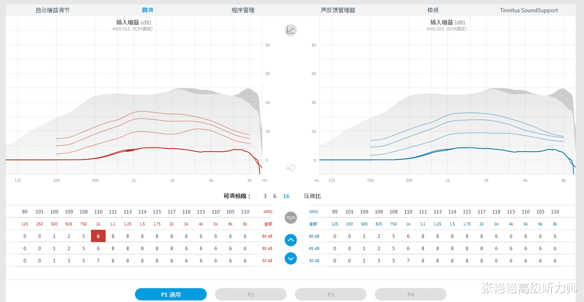 摩托罗拉|验配师与音响师的对话,揭示助听器和普通电子产品的“本质”区别