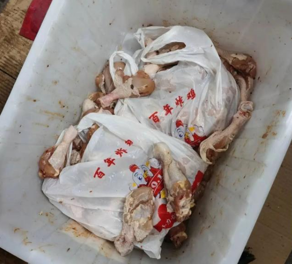 中药|女子体内取出468颗结石:惜命的最好方式不是养生,而是好好吃饭