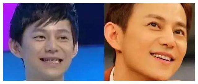 娱乐圈|瞅瞅娱乐圈这清一色的烤瓷牙,上头~