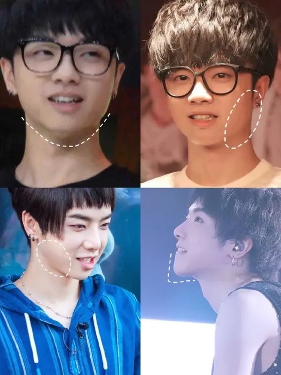 整容|审美堪忧！这10位小鲜肉，“整丑”成锥子脸，真是捡芝麻丢西瓜