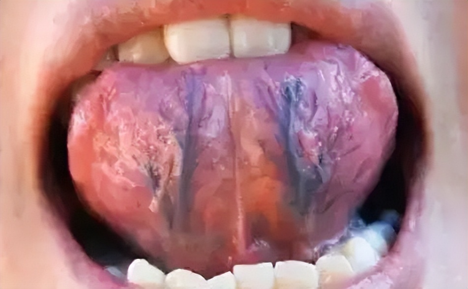 中药|唇紫舌暗,瘀血阻滞?四味中药,补血活血,行气止痛,散瘀血