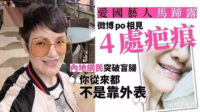 马蹄露|TVB“御用丑角”马蹄露：因爱国被打伤不后悔，坚持为大陆捐款
