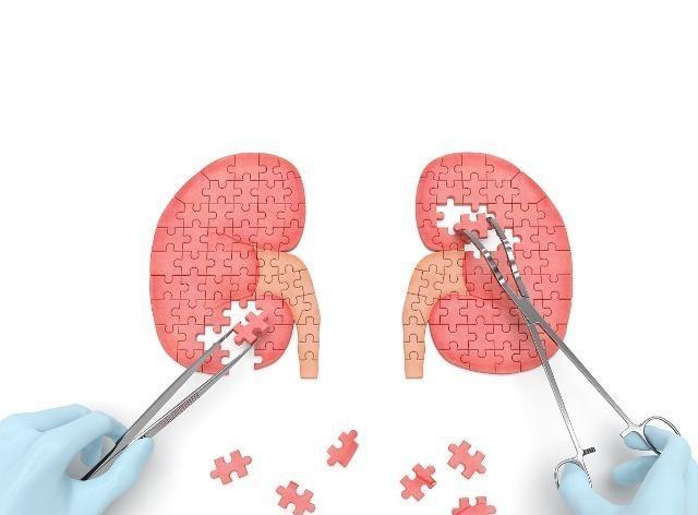 黑豆|黑豆和“它”是最佳搭配，若能坚持吃，或许肾补满，血管也干净了