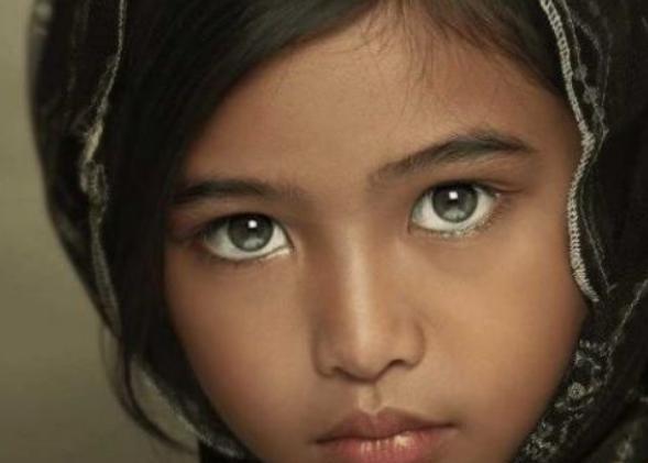 人可能有三只眼睛吗？印度小女孩的第三只眼，连科学家也无法解释