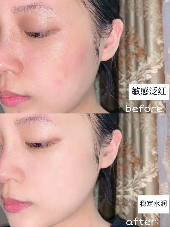 赵露思 赵露思素颜被赞，分享的护肤好物便宜好用，效果一点不输大牌