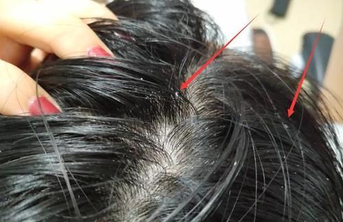 洗发水 堪称洗发界的“阿玛尼”效果比沙宣、欧莱雅还好,却“无人问津”