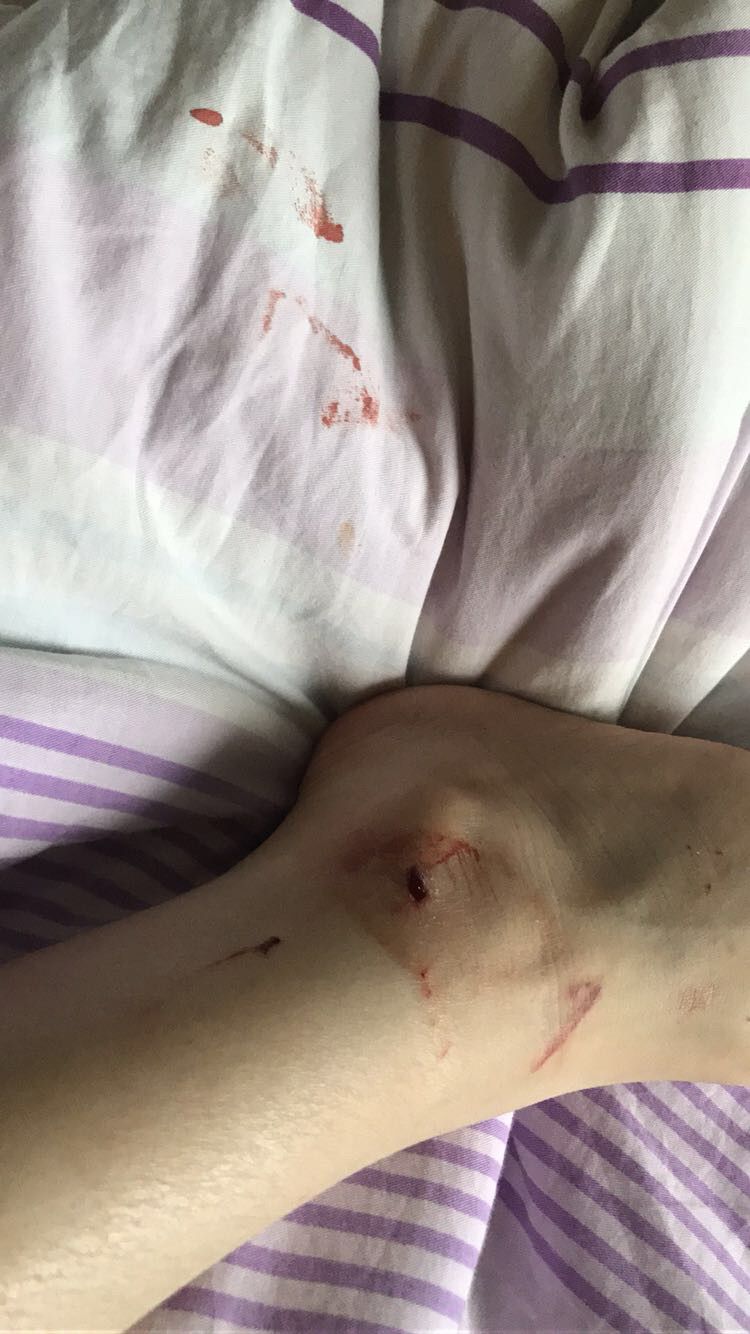 好吓人,我家淋浴房突然爆了!装修公司拒不负责,还说正常?