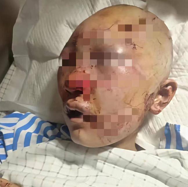 浙江公厕女子被打一个月后,比魔鬼更可怕的是评论区的“人性”