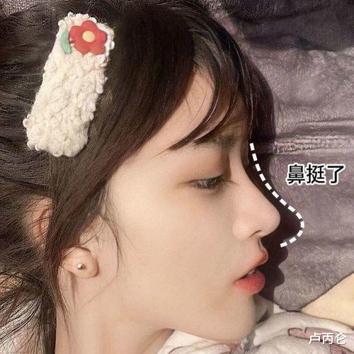 医生|为什么卢医生总说:别再修了,越修越假!