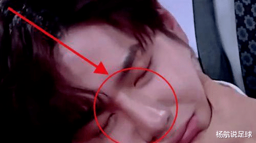 杨紫|杨紫凹坑的下巴，王一博折断的鼻梁，整容脸在镜头下真是无处遁形