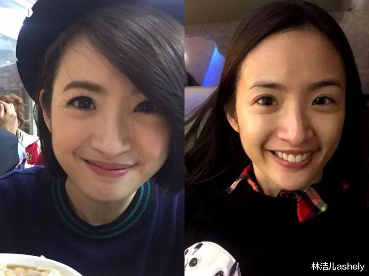瘦脸 瘦了14斤的杨紫，颜值、气质都提升一大截，减肥得先瘦脸才是王道
