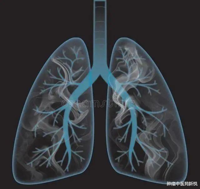 中医养生|戒烟后，肺结节能彻底痊愈吗？医生：这2种食疗对肺有帮助
