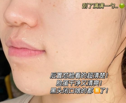 连衣裙 说实话：这7款国货护肤品，效果很好还便宜，都是跟奶奶辈种草的
