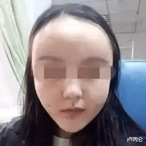 尿酸|整形不想变假人，这4点原则要记住！