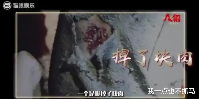 凤姐|脸胖成猪头，男友都看不下去？