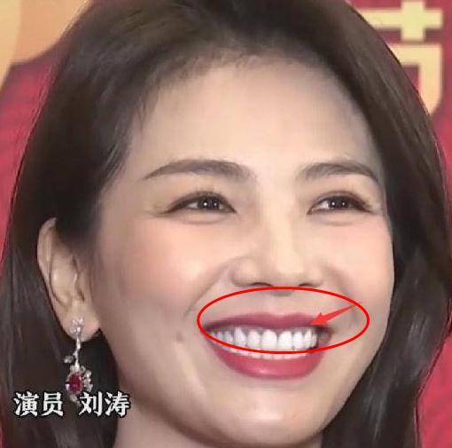 杨幂|明星变美花样多，杨幂用假屁股垫，倪妮贴反了假眉毛