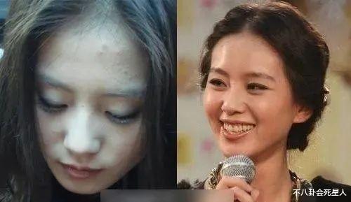 明星素颜|黑眼圈,眼袋,痘痘,去掉美颜滤镜的素颜,绝美女星回归普通人