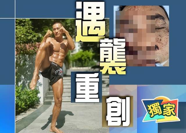 港星黄竣锋遇袭被砍三刀,脸部缝100针险没命,凶徒竟称砍错人