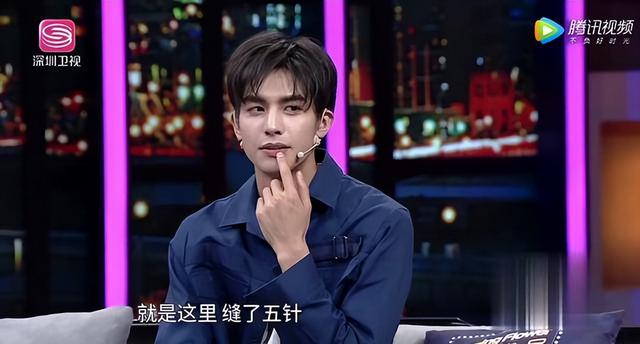明星 一张嘴“毁”了一张脸，这10位明星告诉你，嘴巴能有多拖垮颜值