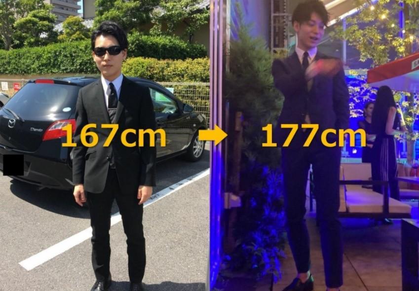 2014年,20岁李亚诺花16万断骨,只为长高7.2厘米,如今后悔不迭