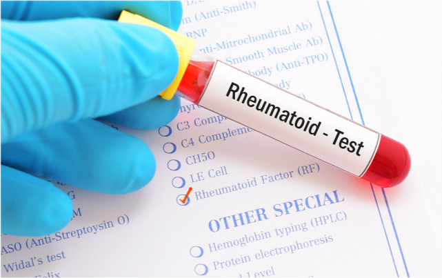 淋巴癌|尿酸高不高，小便时看一眼就知晓？提醒: 如果尿液有这1种表现, 应当重视