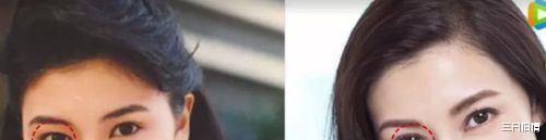整容风也刮到了香港,这8位港圈大美人竟跑去DO脸,结局一言难尽