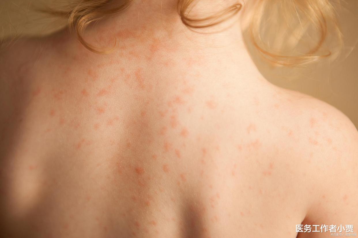 哺乳期妇女可以化妆吗?学会3招,哺乳期也可以护肤