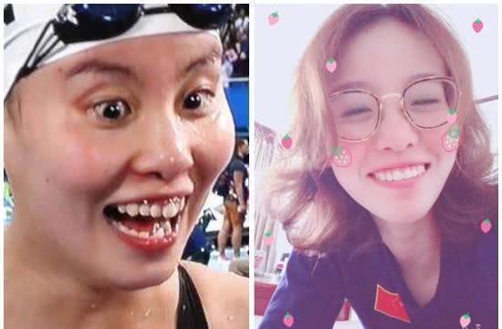 运动员|女运动员都是潜力股：郭跃从假小子变女神，傅园慧整牙如换脸头