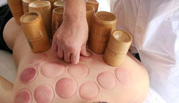 拔罐|拔罐出来的淤血是身体内的毒素吗?其实要把拔罐的基础理念先搞懂