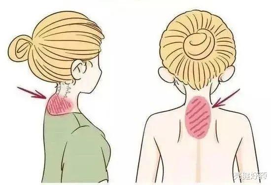 富贵包|去富贵包,坚持1个动作就会改善