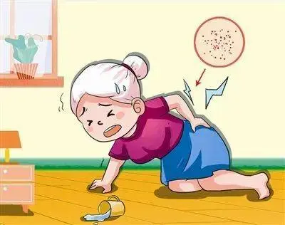 拔火罐|腰疼是什么原因引起的? 可能是这6种原因