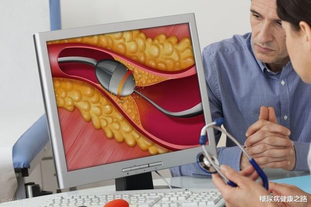 胆囊|辟谣:高血脂必须吃他汀?低密度脂蛋白是关键,分清人群来用药