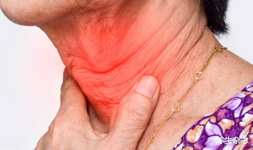 饮食|甲减给身体带来的伤害，你万万想不到，饮食调理需注意四个问题