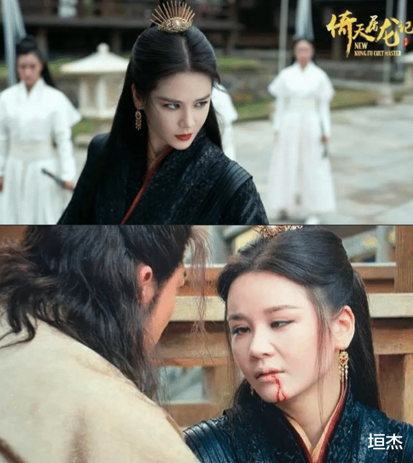 整容|满脸僵硬、肿成馒头，明明颜值拉胯，就别硬装“美少女”了