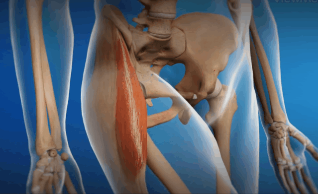 |「弹响髋」大腿根嘎嘣响,不仅尴尬还伤身?