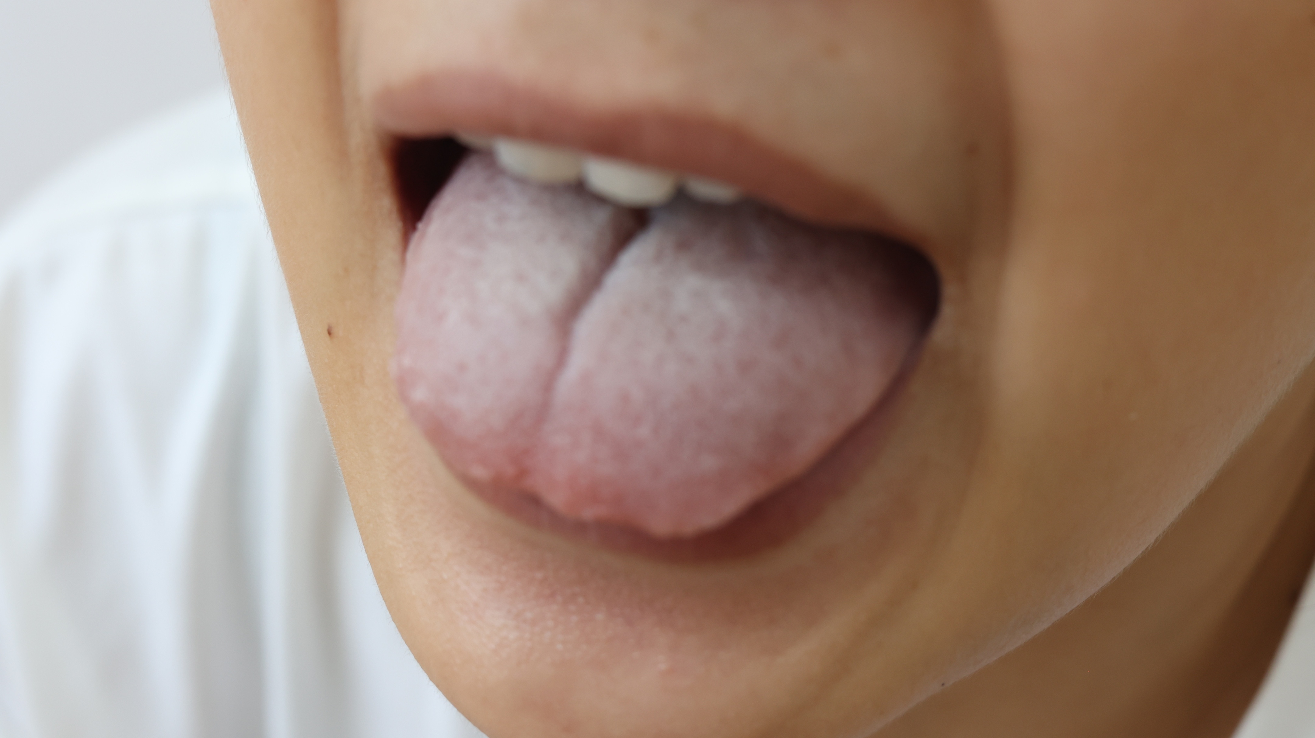 运动|肝脏是否健康,看嘴能知晓?嘴里若有3种异常,或许要养护肝脏了