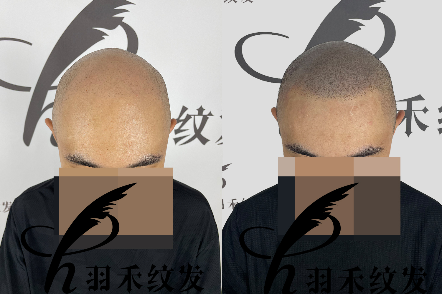 纹发后为什么视觉上有立体感?