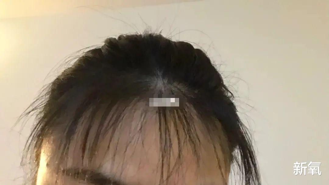 牛仔裤 为什么胎毛刘海时而油腻，时而显嫩？