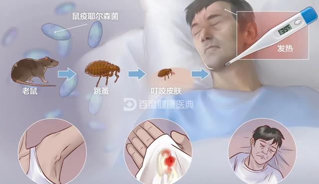 屎从天降,墙壁上全是排泄物,给黑死病加buff夺走2500万条人命