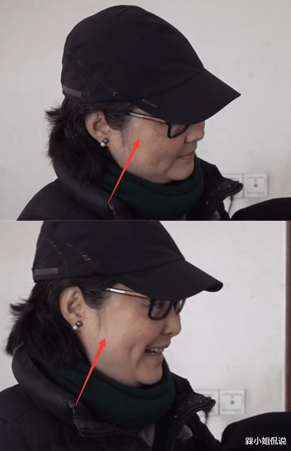 袁立|袁立长胖30斤仍吸引人,打扮朴素慰问病人,脸上发福浮肿快认不出