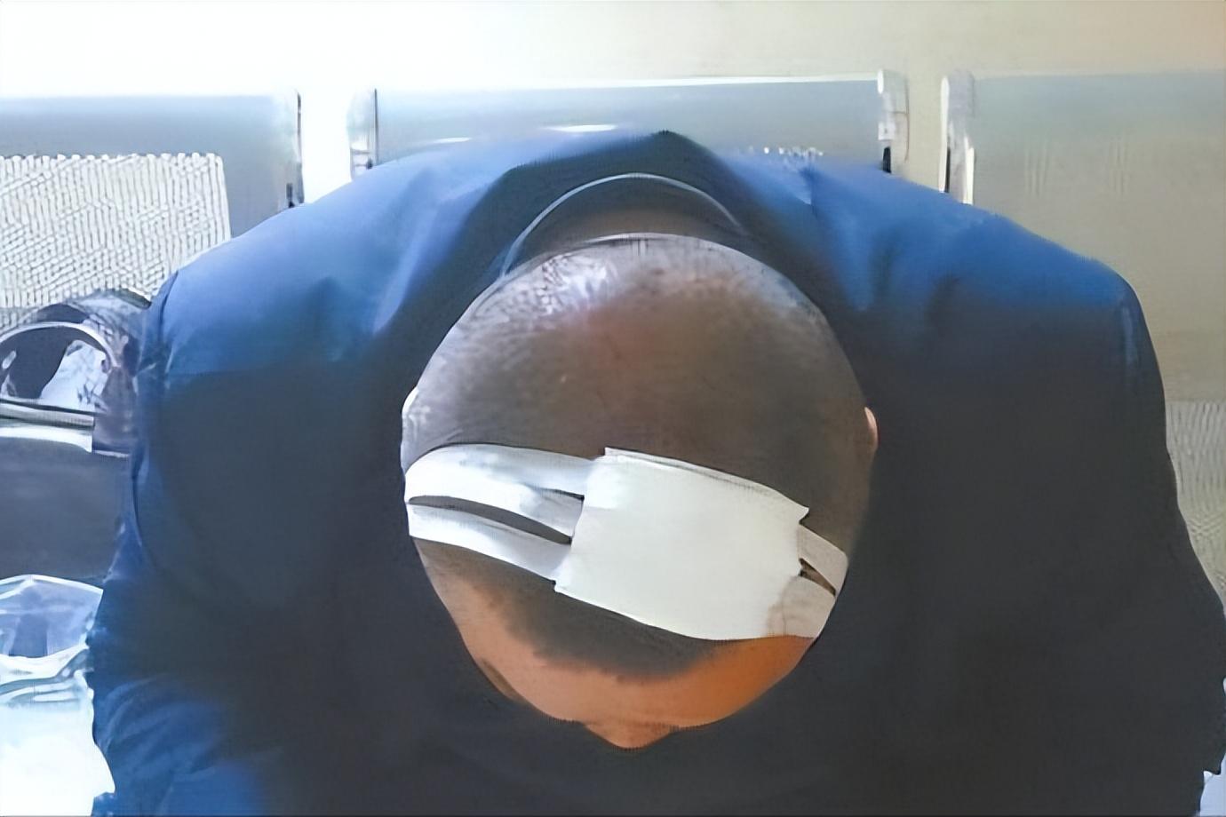 河北男子为逼情人离婚,拿钥匙扎进情人丈夫左眼,村民:没人敢管