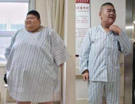 他是“中国第一胖”,为减肥切胃也没用,却因爱情一年减400斤