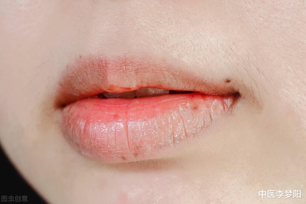 地黄|阴虚火旺,用了知柏地黄没效果?李医生教你一招,滋阴去火