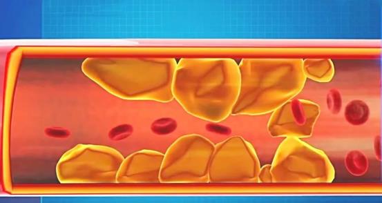 糖尿病|不吃早饭VS不吃晚饭,哪个更危险?这些研究告诉你答案