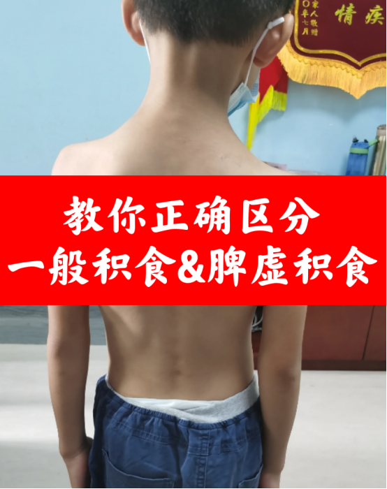 祛湿|如何区别一般积食跟脾虚积食,详解