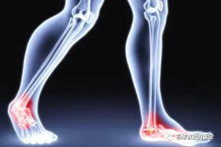 疾病|关节炎、骨质疏松、骨质增生、骨折等骨病的病理分析及解决方法!