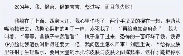 侣皓吉吉|侣皓吉吉：毁容后父亲海岩心疼，被强捧的“太子”，当导演终出名